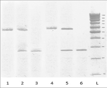 Fig: Electrophoregramm of human DNA PCR products amplification of ACE I/D gene polymorphism. Note: L – DNA Ladder "GeneRuler 100 bp" (1000-100 bp); lines 1, 4 – homozygous II genotype; lines 2, 5 – heterozygous ID variant; lines 3, 6 – homozygous DD variant.