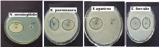 Fig: Secondary screening of antibacterial activity of eight Marine sponges against the various CSF influenced Bacterial Pathogens